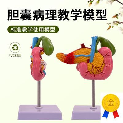 黄河胰腺十二指肠胆囊u病理模型胆结实消化系统模型肝医学