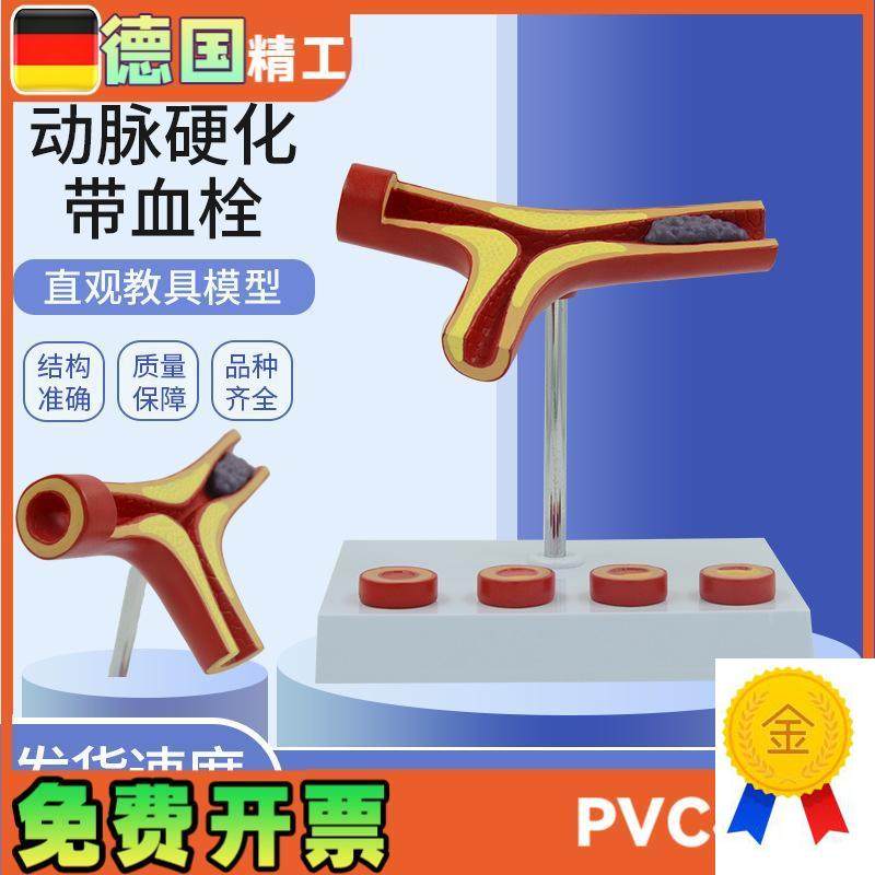 人体心血管动脉硬化解剖模型老年冠心病血X栓教学心内科