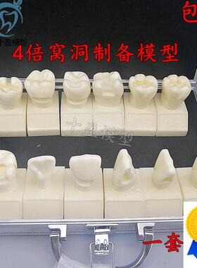牙科4倍大窝洞制备模型四倍牙齿备牙标准示范嵌体洞R型12个M7025