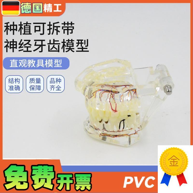 德国】PNT-OR16口腔牙科种植可拆带神经M牙齿模型可拆卸口腔修复