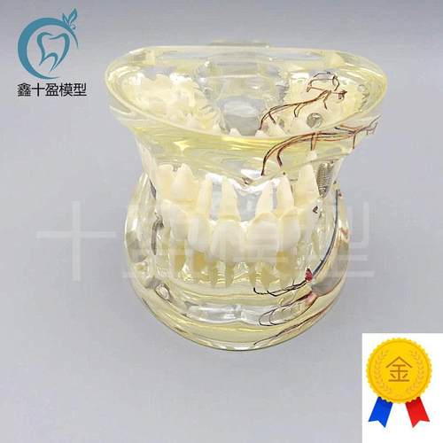 牙科水晶牙齿病理模型M4019-2成人透J明病理牙模型带牙神经和嵌体