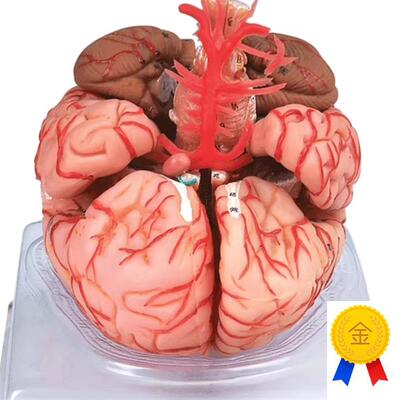 脑动脉模型GD/PA18220