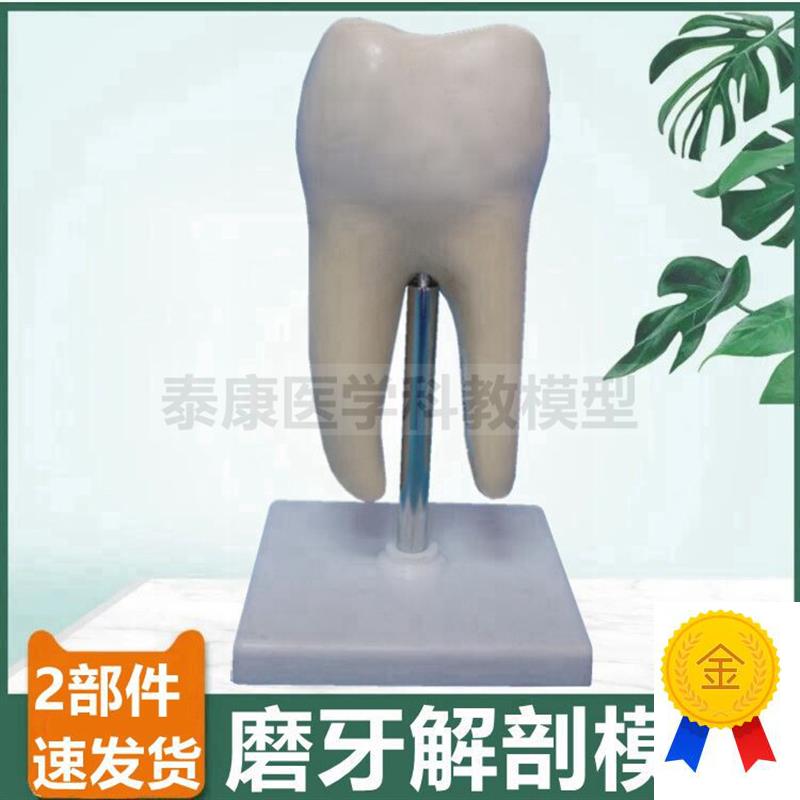 大型磨牙模型臼齿结构可拆卸蛀牙病理口腔牙科摆件牙Y医考试用模