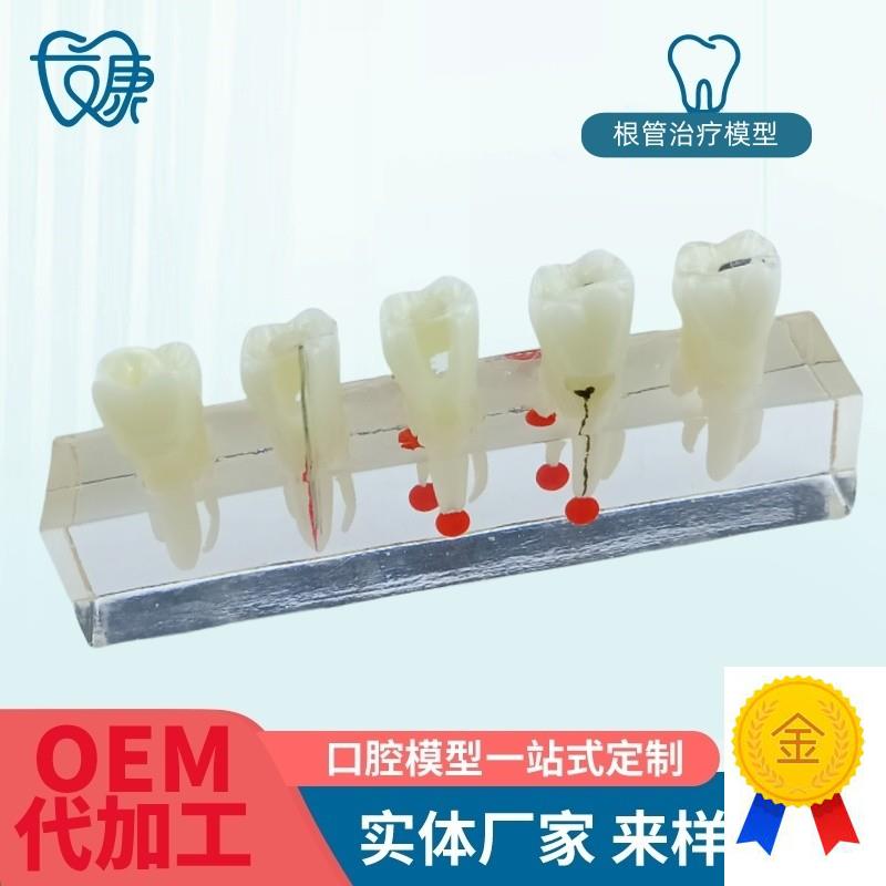 根管牙髓治疗模型牙科口腔教学牙模种植修M复病理模型医患沟通模