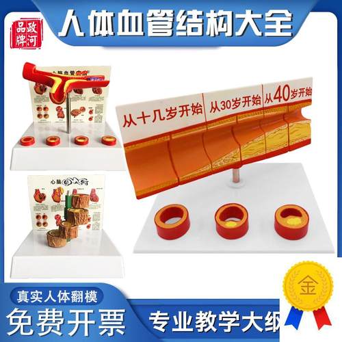 政河人体血管变化模型p动脉血管阻塞病理演示医院学校诊所教学用