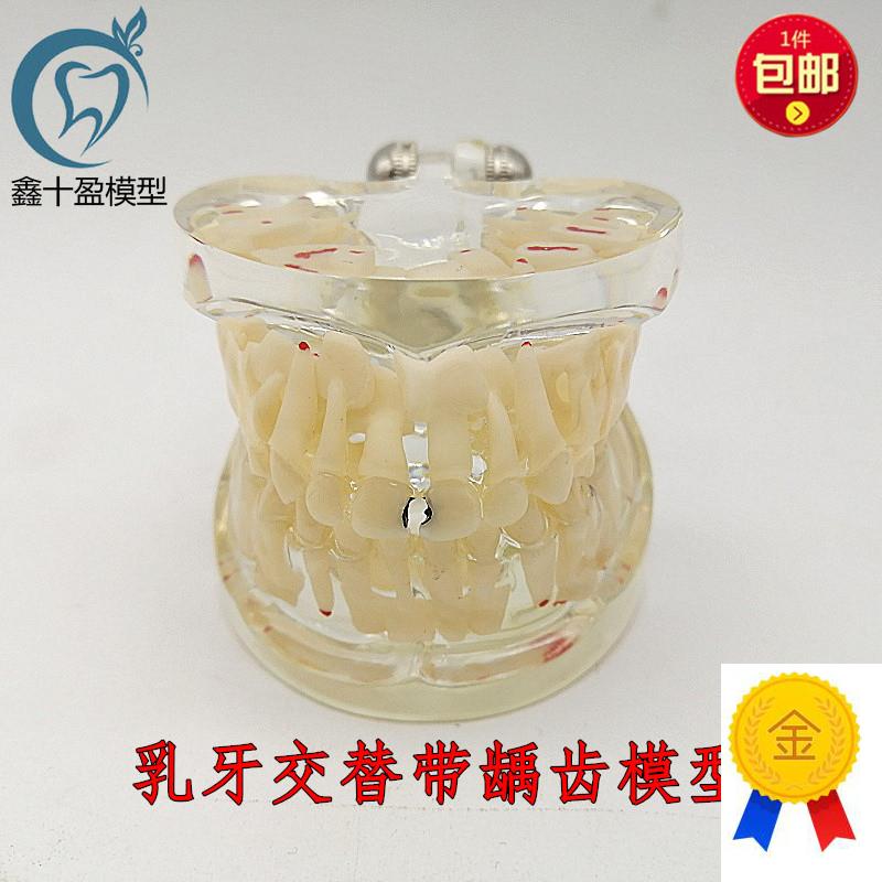 乳牙模型恒牙模型乳牙龋齿牙模型教学窝沟封闭口腔W齿科材料C12