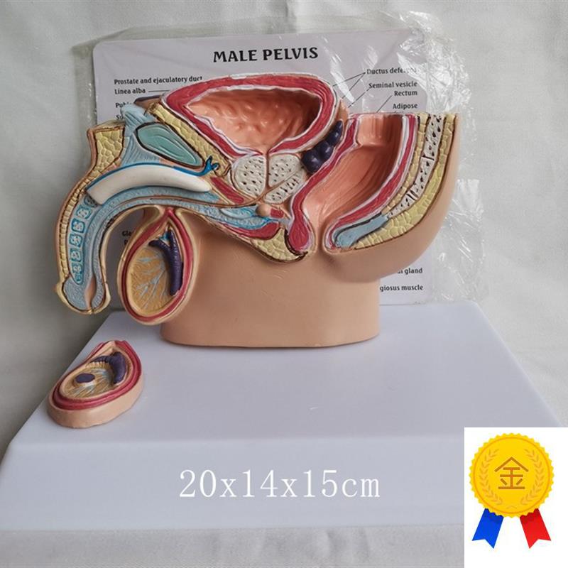 人体男性腹腔病态模型健康保健医用教学U医患病理讲解