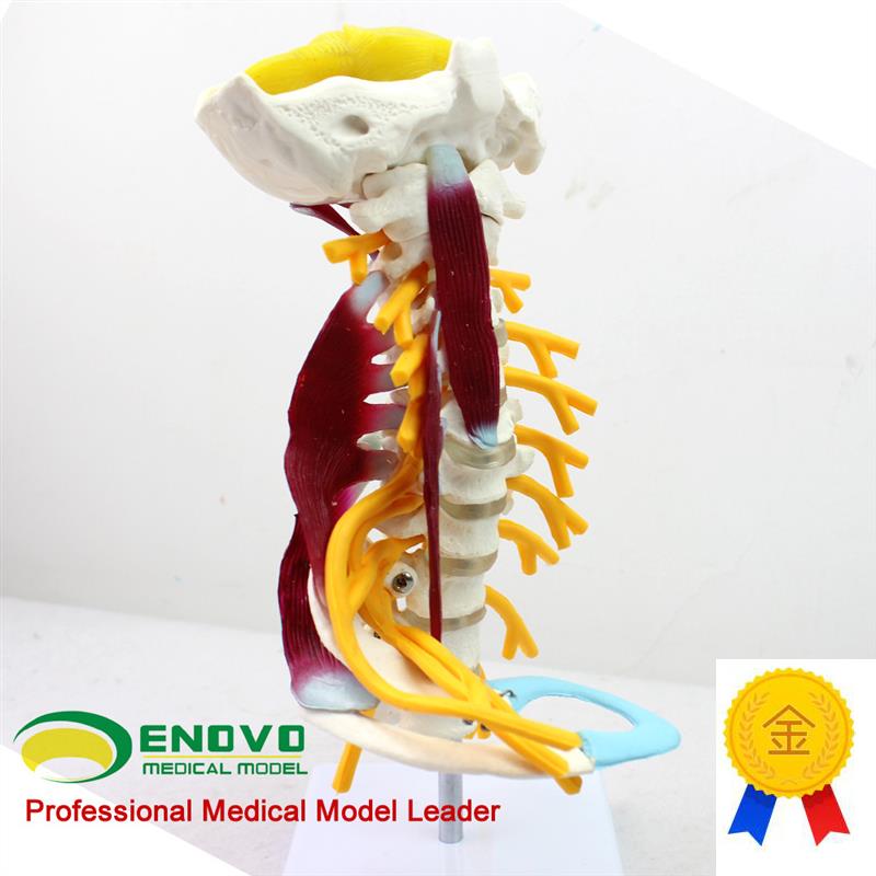 ENOVO颐诺医学人体颈椎模型颈臂丛神I经肌肉模型人体骨骼标本模型