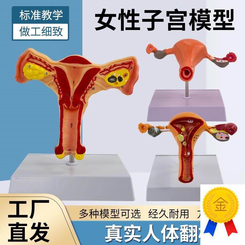 人体子宫模型g女性生殖模型阴道卵巢模型教学模具病理变化科学教