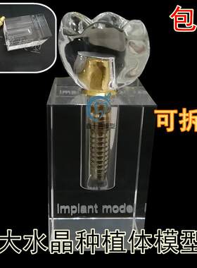 牙科材料水晶种i植体模型大水晶可拆卸口腔教学牙科饰品2019