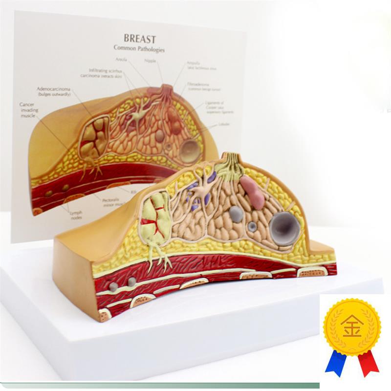 ENOVO颐诺女性乳房常见病解剖模型乳房乳腺癌肿瘤结Y节模型母乳哺