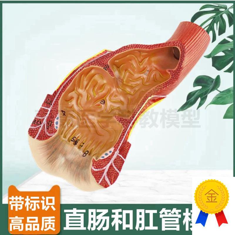 直肠模型肛管肛周末n端肛肠医生用痔疮回肠盲肠阑尾大小肠病理结
