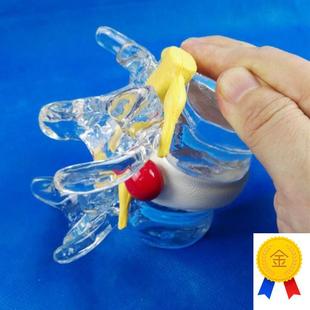 脊椎和脊髓挤压演示模型人y体医用医学教学模型脊髓泡泡球