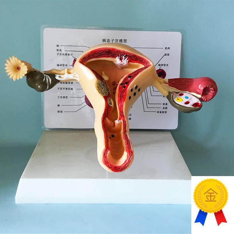 子宫模型生殖器女l性器官解剖人体教学教仪医用教具包邮厂家直销