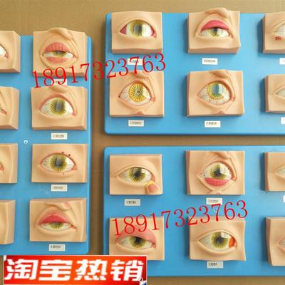 常见眼病模型20种 眼睛疾病模型 眼科常见疾病模型 眼球病变模型