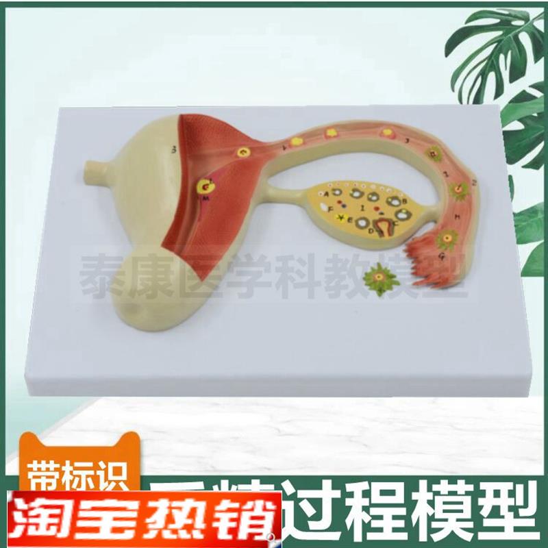 受精过程模型 精子和卵子结合 生殖胚胎妊娠发育过程妇产科教学用