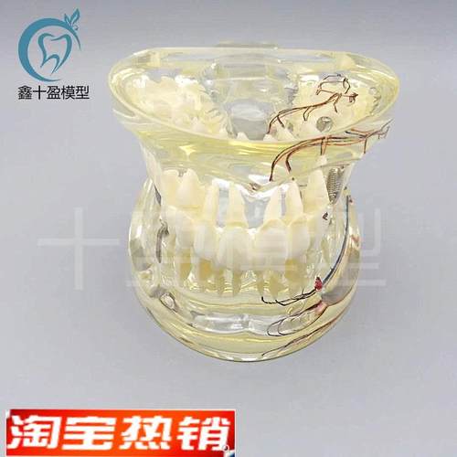 牙科水晶牙齿病理模型M4019-2成人透明病理牙模型 带牙神经和嵌体