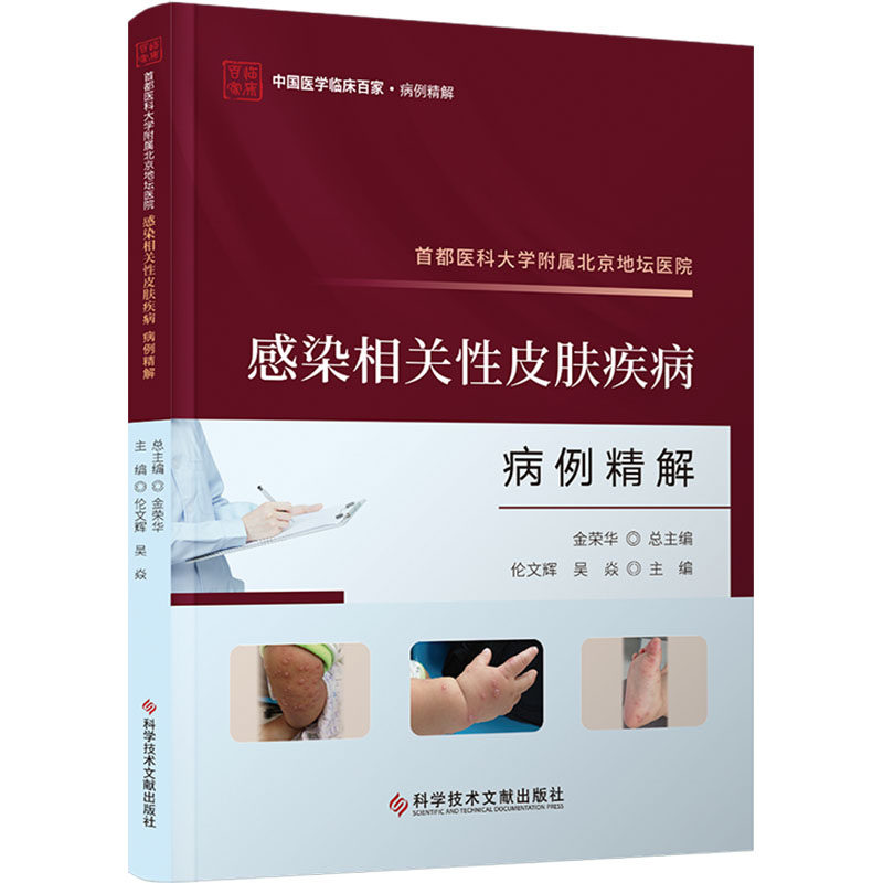 首都医科大学附属北京地坛医院感染相关性皮肤疾病病例精解 伦文辉,吴焱 编 皮肤病学/性病学生活 新华书店正版图书籍