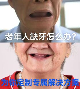 老年人缺牙半口全口活动假牙吸附性义齿咨询