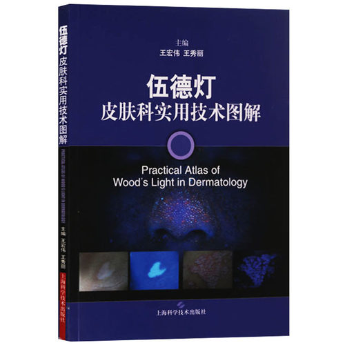 伍德灯皮肤科实用技术图解 王宏伟 等主编 皮肤病学 性病学生活 医师临床应用指导书籍 上海科学技术出版社