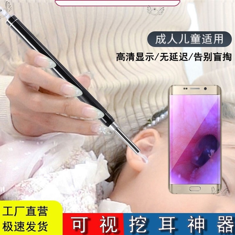 掏耳神器可视采耳仪器挖耳勺发光耳朵清洁工具高清可视内视镜套装