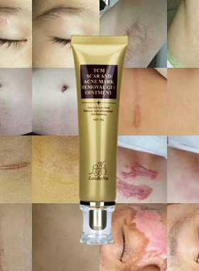 LANBENA 蓝蓓娜TCM SCAR AND ACNE MARK REMOVAL GEL 修复膏