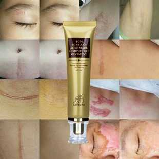 LANBENA 蓝蓓娜TCM SCAR AND ACNE MARK REMOVAL GEL 修复膏