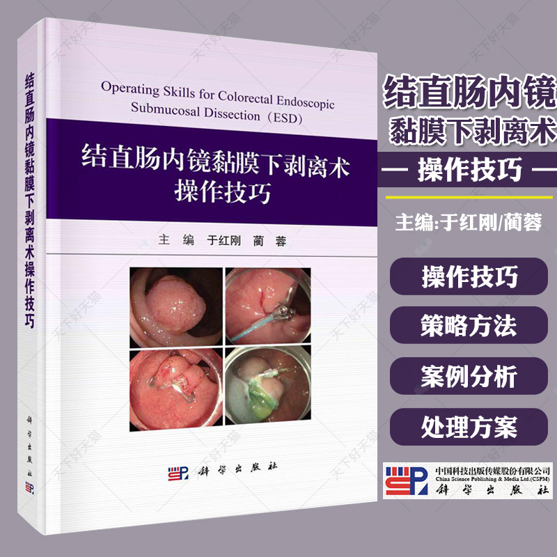结直肠内镜黏膜下剥离术操作技巧 于红刚 蔺蓉主编 科学出版社 结直肠ESD的基本操作及要点 缺血性结肠炎 护理及麻醉团队的配合
