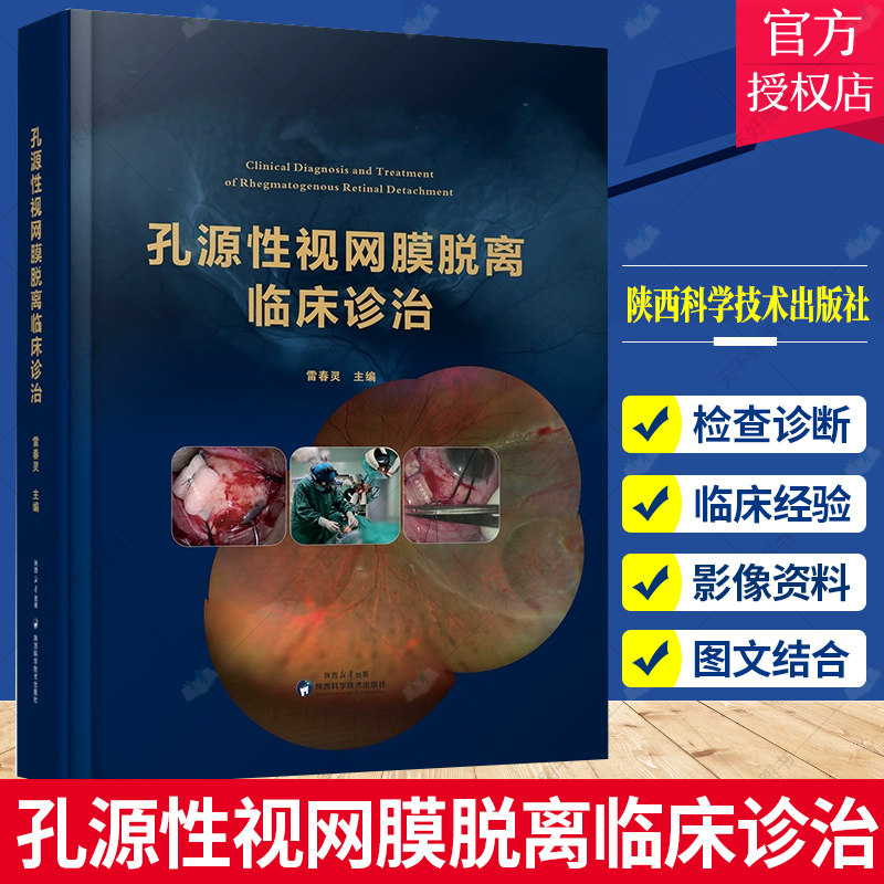孔源性视网膜脱离临床诊治 雷春灵视网膜脱离手术康复眼保健改善保护视力指导临床西安市第四医院眼科验光眼外科手术医学病例书籍