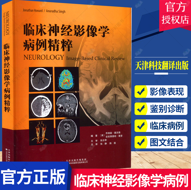 临床神经影像学病例精粹 张静 陈薇主译 神经系统疾病影像学 癫痫 脑血管病 自身免疫疾病 脱髓鞘性疾病等 神经病学领域书籍
