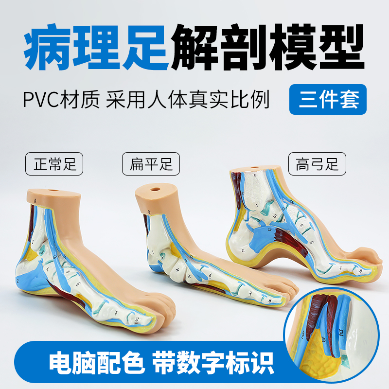 正常足 扁平足 弓型足 模型 足部病理模型人体足部肌肉解剖模型