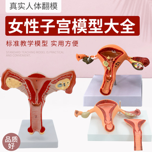 双侧卵巢子宫 仿真女性内外生殖器模具 妇产科教学演示通用模型