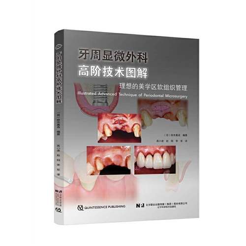 正版书籍 牙周显微外科高阶技术图解铃木真名辽宁科学技术出版社自由组套  人天书店畅销书排行榜