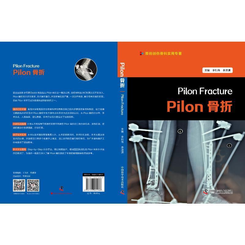 Pilon骨折 李钊伟   医药卫生书籍