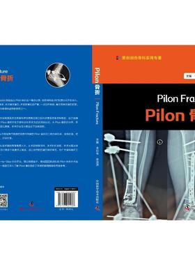 Pilon骨折 李钊伟   医药卫生书籍