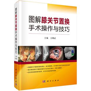 正版书籍 图解膝关节置换手术操作与技巧王坤正科学出版社医药卫生人工关节膝关节移植术图解 人天书店畅销书排行榜
