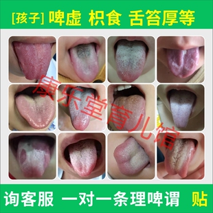 一对一儿童消积食去内热脾胃调理厌食上火挑食舌苔厚地图舌保健贴