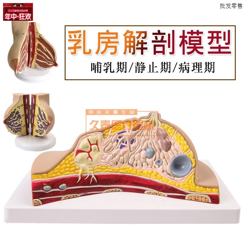 乳房病理模型乳房病变模型乳m房模型乳房解剖模型哺乳培训模型