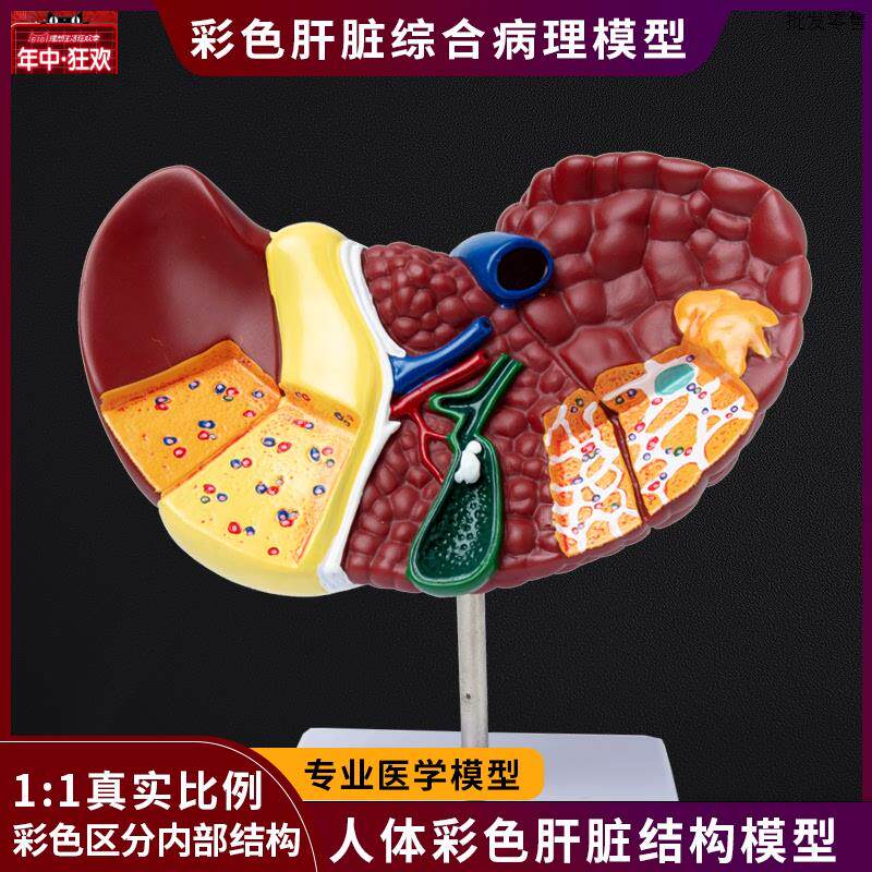 医学彷真人体肝脏解剖模型肝门胆囊胆管结构消化系统a器官演示教
