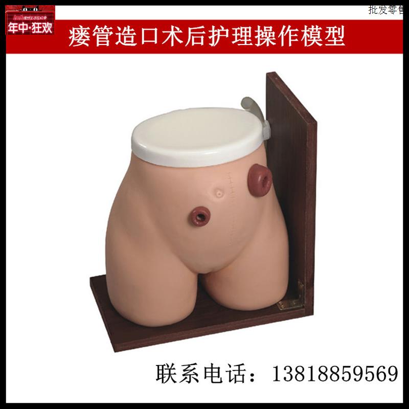 瘘管造口术V后护理操作模型