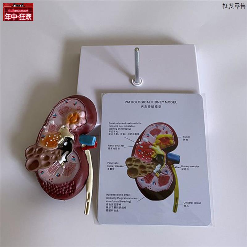 狗泌尿系统模型病理肾脏囊x犬科动物兽医药促销宠物医院教学展示