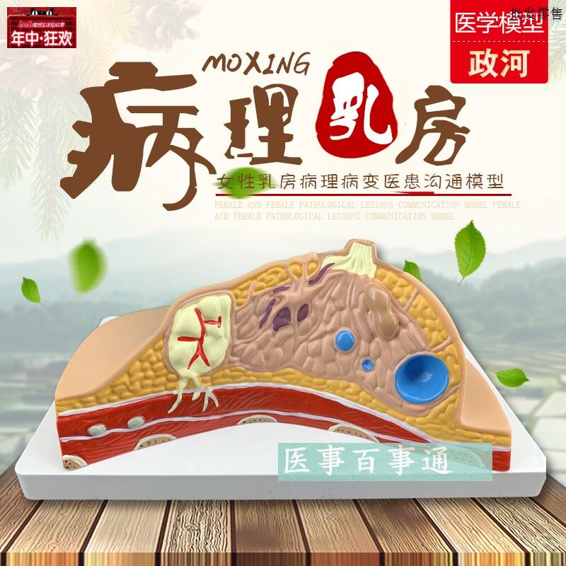 乳房模型解剖催乳O培训健康教育生理生物生殖哺乳期妇女用具器材