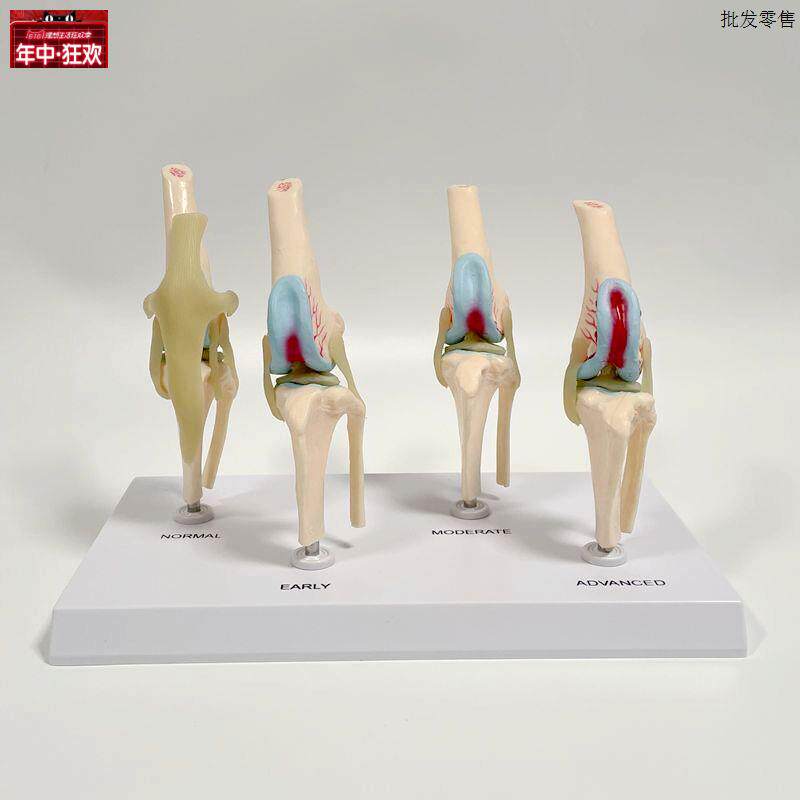 福臻模型狗膝关n节软骨损伤半月板韧带早中晚期病变兽医药促销礼