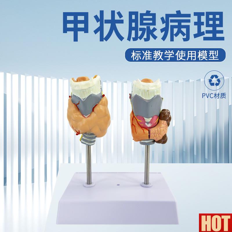 理甲状腺模型 喉头解剖模型 甲状腺留 甲T状线囊中 甲状线病