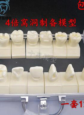 牙科4倍大窝洞制备模n型四倍牙齿备牙标准示范嵌体洞型12个M7025