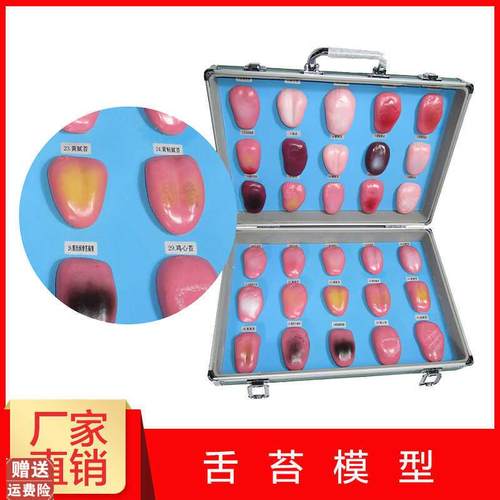 人体舌头舌苔模型常见病舌苔病变比较中医口腔望V诊教学解剖模型