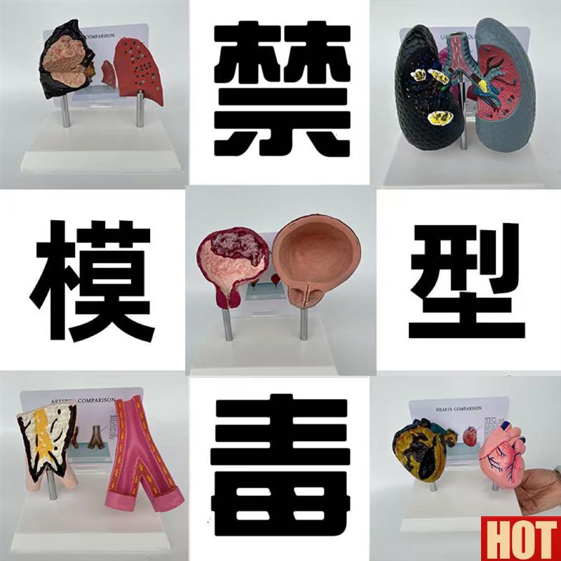 体正常内脏吸烟病变器官对比心肺部膀胱血管口d腔气管胎医用模型