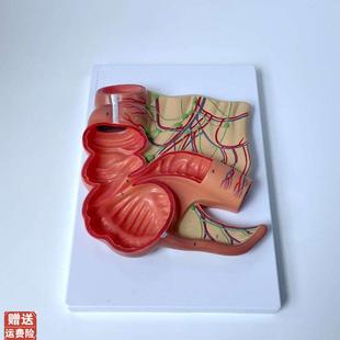 盲肠模型阑尾肠系膜淋巴结人体消化道大肠小肠肛肠医X院展示医患