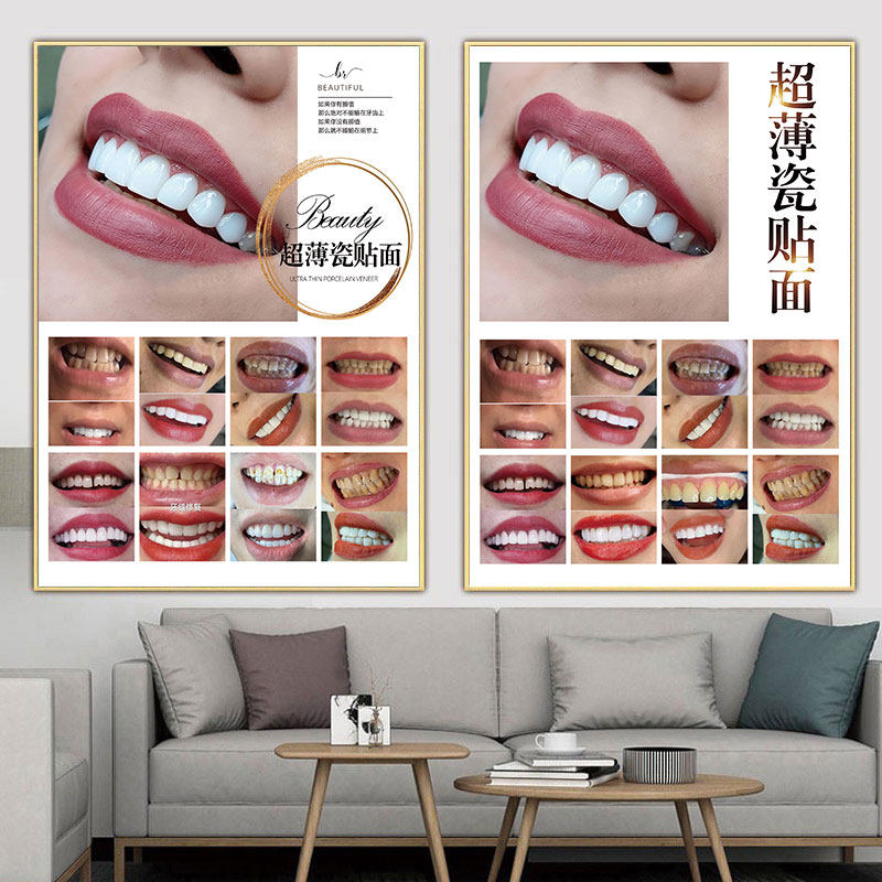 超薄瓷贴面海报牙贴面挂画牙齿美白宣传画纳米炫齿冰瓷美牙广告图