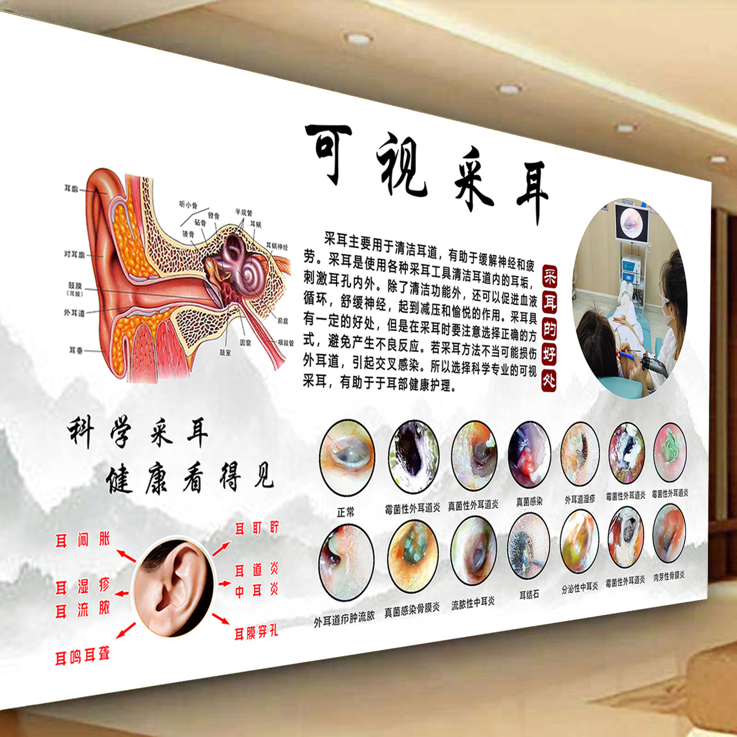 可视采耳广告耳病图片掏耳朵海报